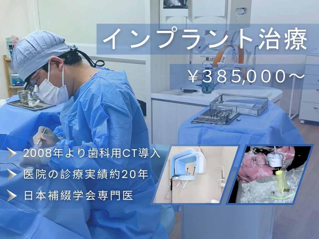 インプラント治療 ￥385,000から