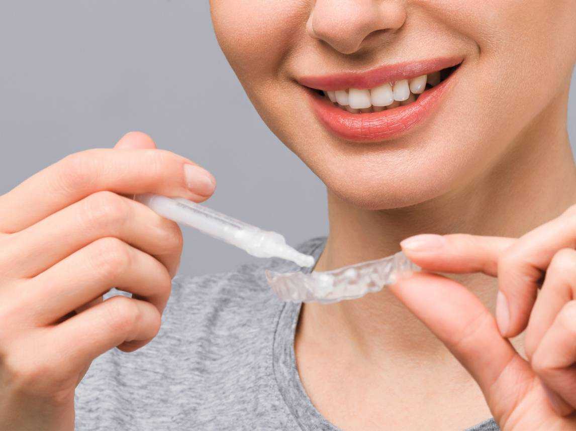 医療ホワイトニング